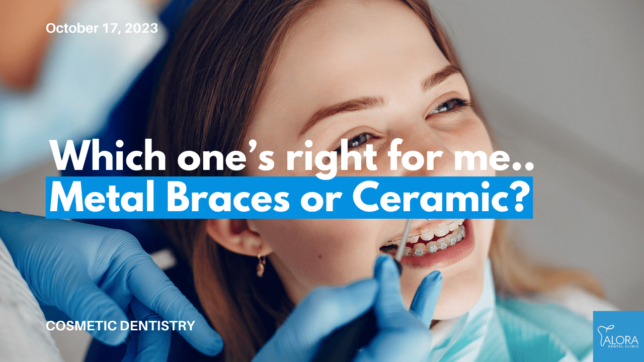 Metal Braces Vs. Ceramic Braces: Which Is Best? | Alora Dental