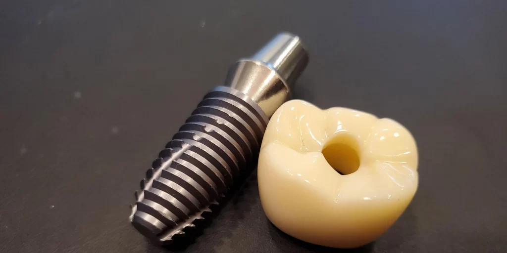 Close-up of a dentist examining a dental implant model with tools on a white background inside a dental clinic