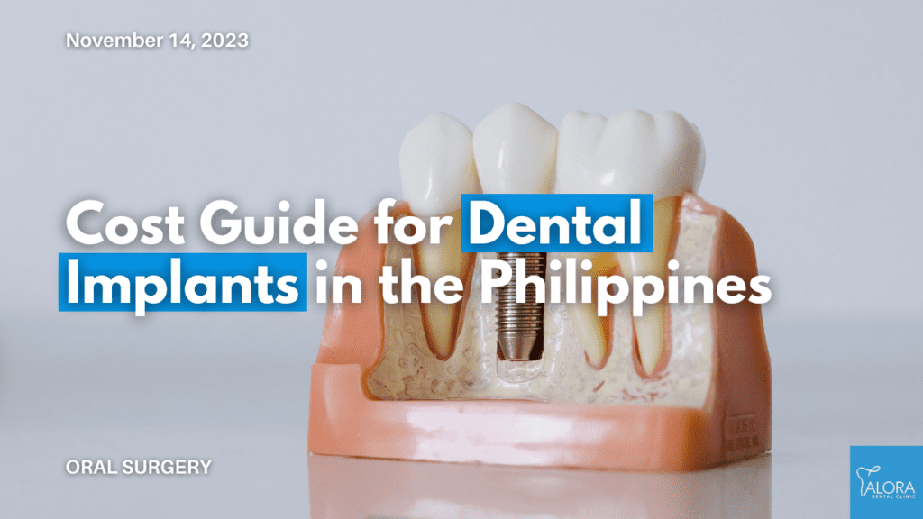 2024 Dental Implant Cost Philippines Alora Dental Clinic   Cover Image For Cost Guide For Dental Implants In The Philippines 1024x576 