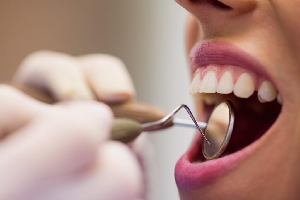 Close-up of a patient's mouth during a dental check-up, with dentist's tool examining the teeth