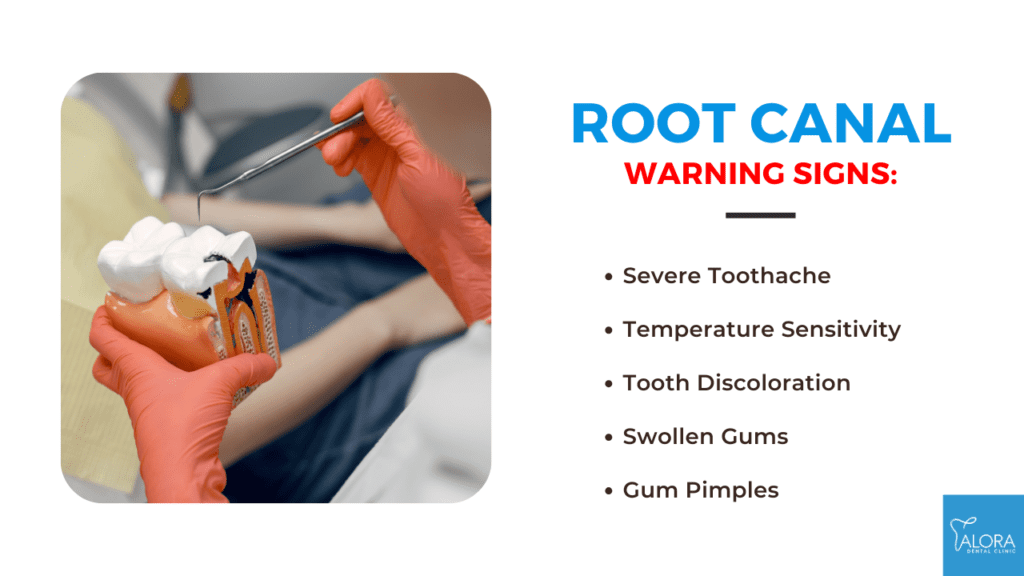 Is it Time for a Root Canal? Know the Signs Alora Dental Clinic