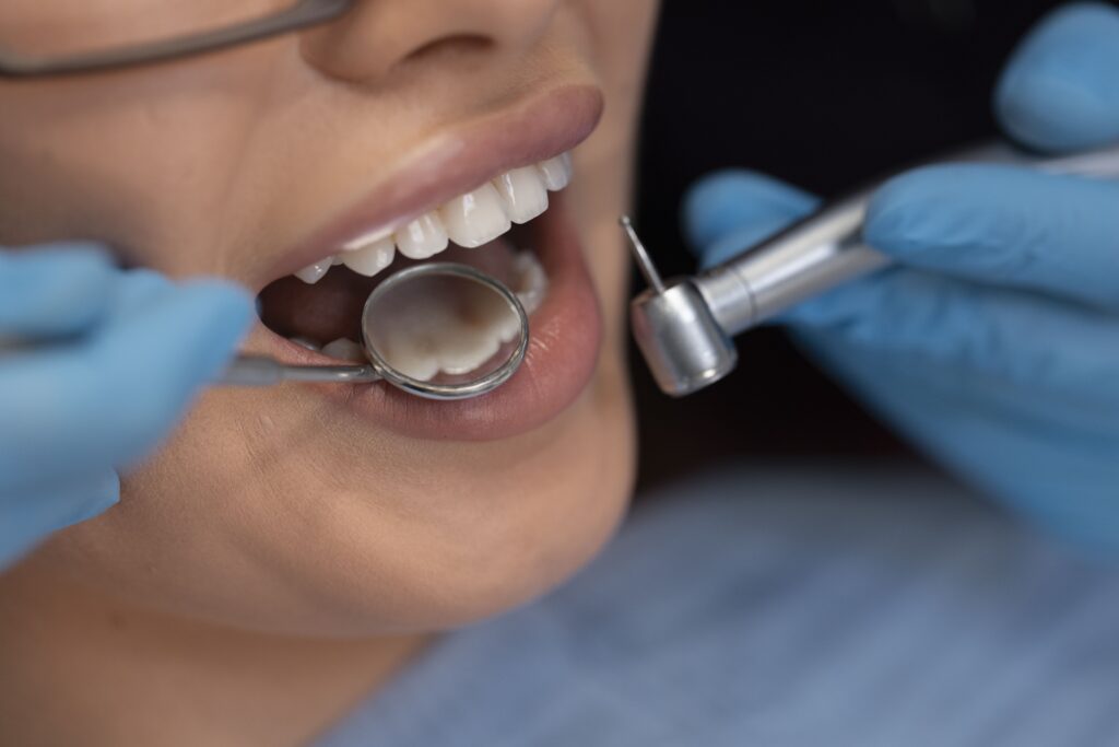 dental-examination-for-zirconia-bridge-fitting