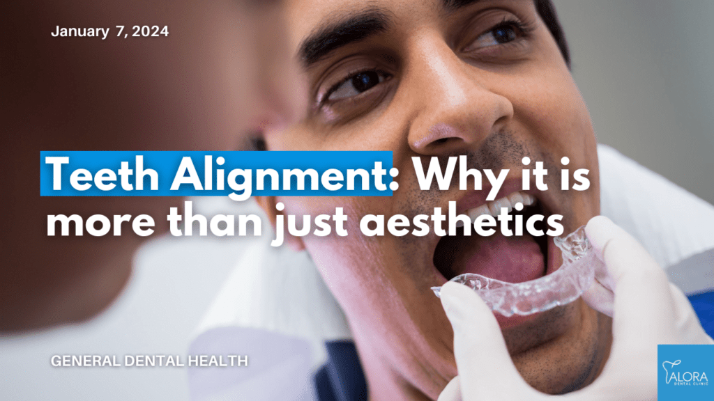 understanding teeth alignment by alora dental clinic