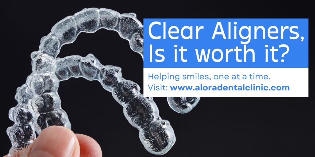 Clear Aligners in the Philippines: Is It Worth the Investment?