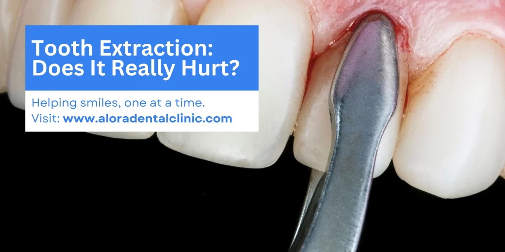 Does Tooth Extraction Hurt by Alora Dental Clinic