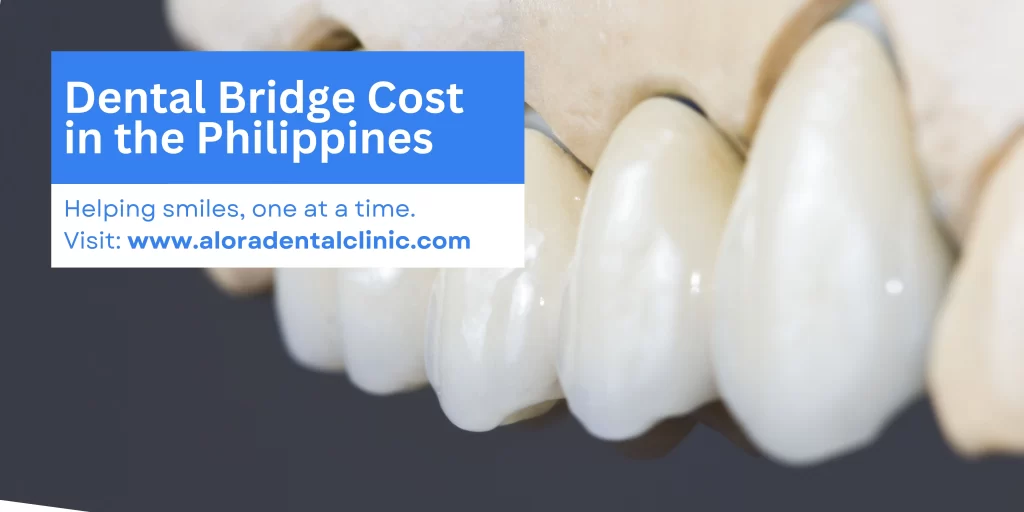 dental bridge cost philippines by alora dental clinic