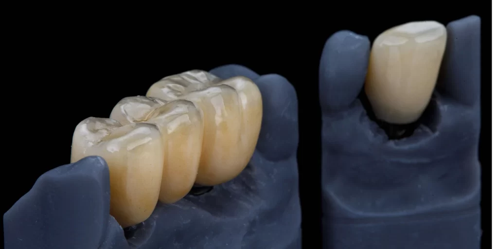 what is zirconia crowns