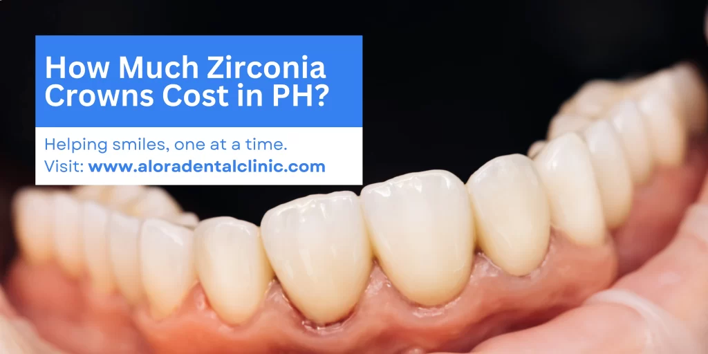 zirconia crown price in the philippines by alora dental clinic