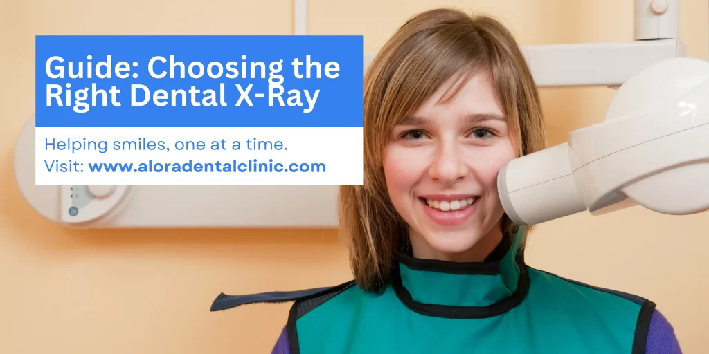 choosing dental xray by alora dental clinic