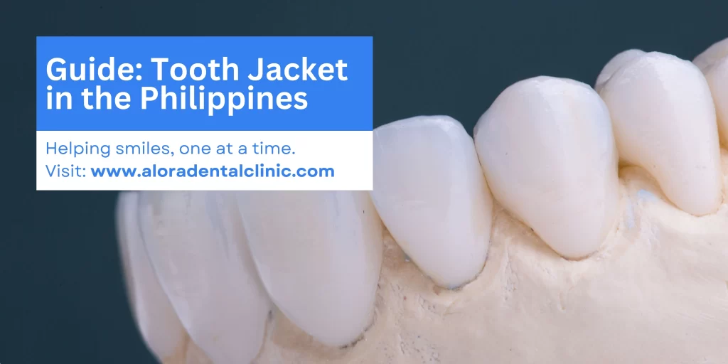 tooth jacket price guide by alora dental clinic