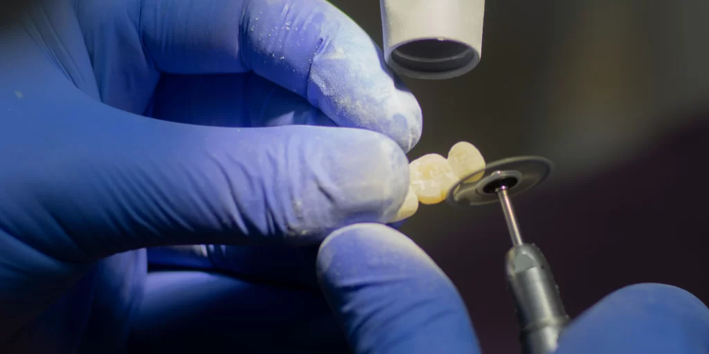 dental implant alternatives